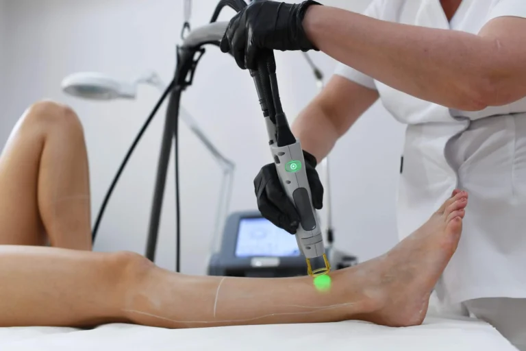 Laser-Haarentfernung bei La Finesse in Bern