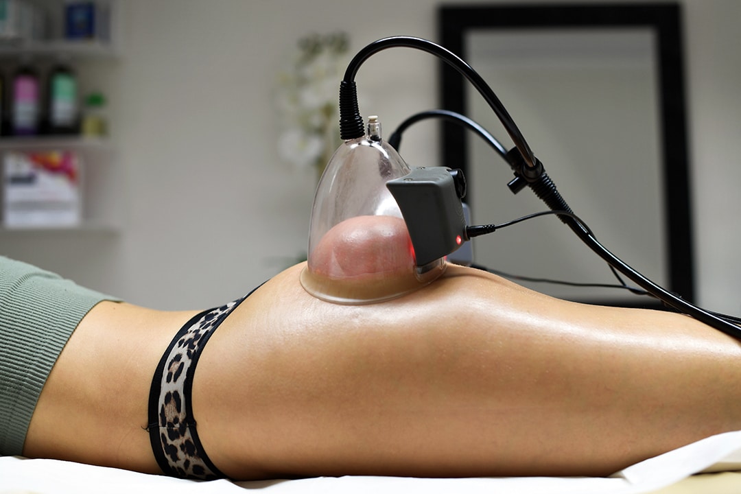 Body-Lifting_3_DSC_2437