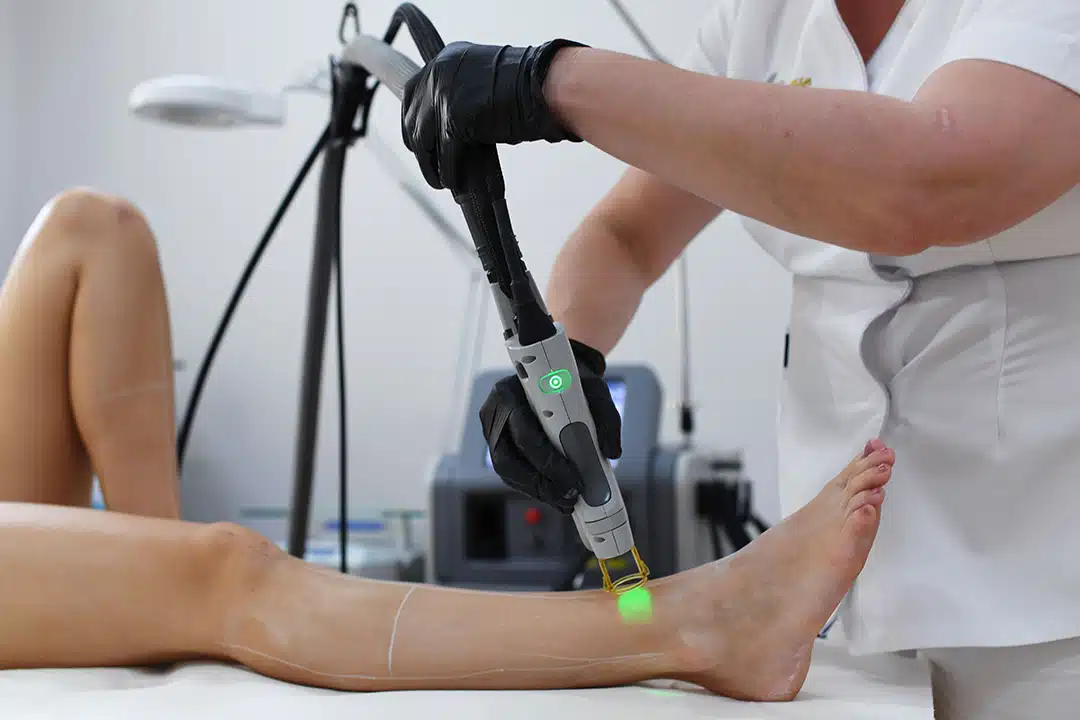 Permanent-hair-removal-_Homepage_DSC_3221 Laser-Haarentfernung am Bein bei La Finesse in Bern