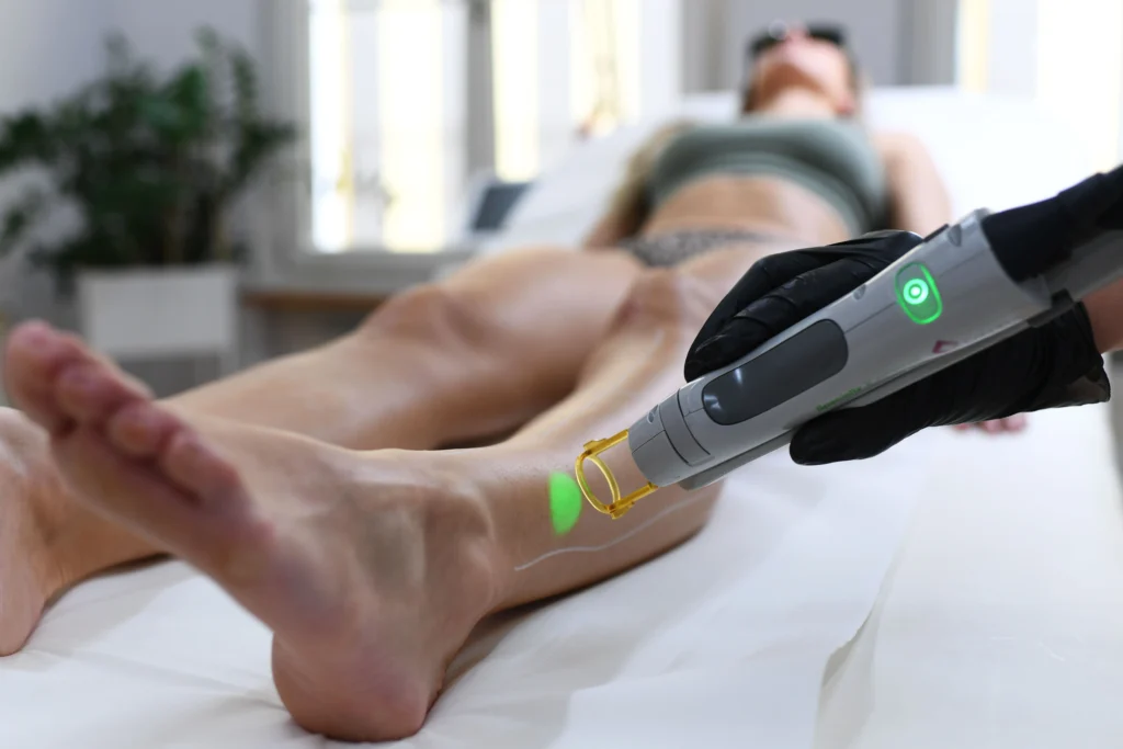 Épilation laser de la jambe au laser alexandrite