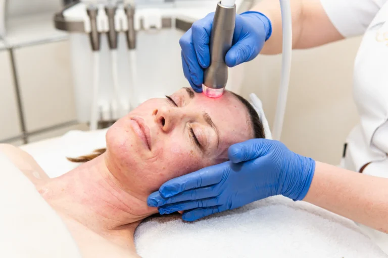 Microneedling mit GlowSolution Reverse Needling bei La Finesse