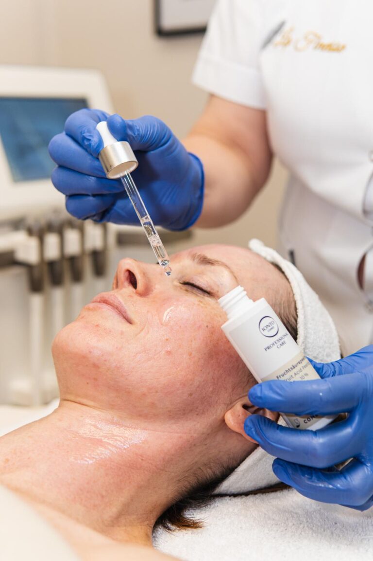 Microneedling: GlowSolution Reverse Needling bei La Finesse in Bern